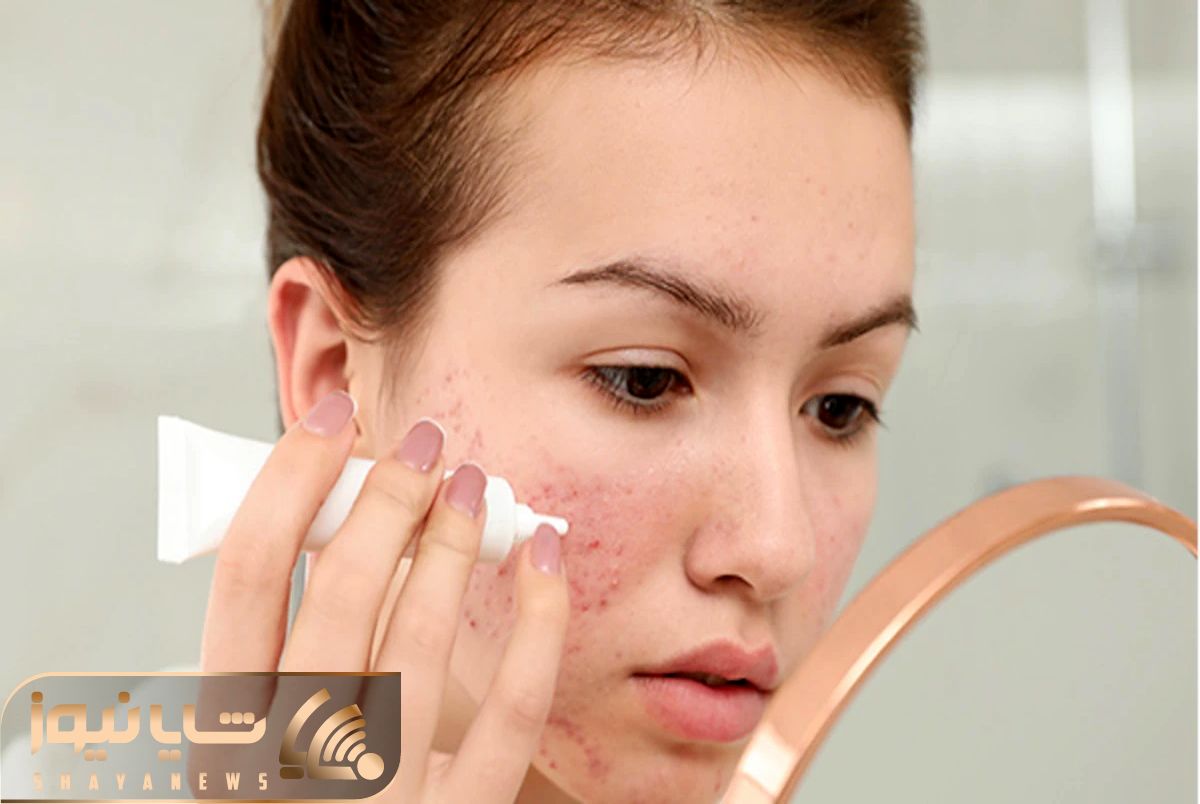 چطور پوستی صاف داشته باشیم؟